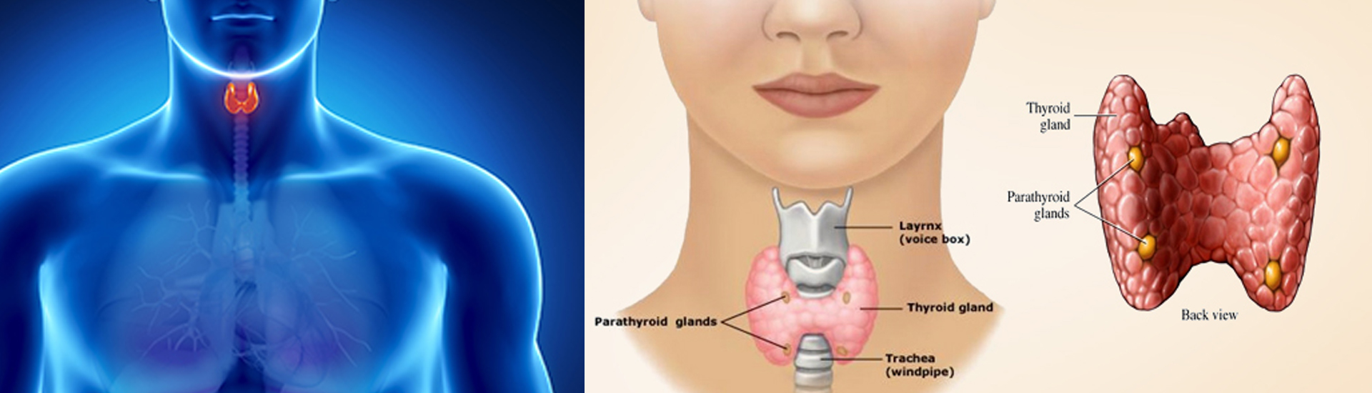 Thyroid Treatment