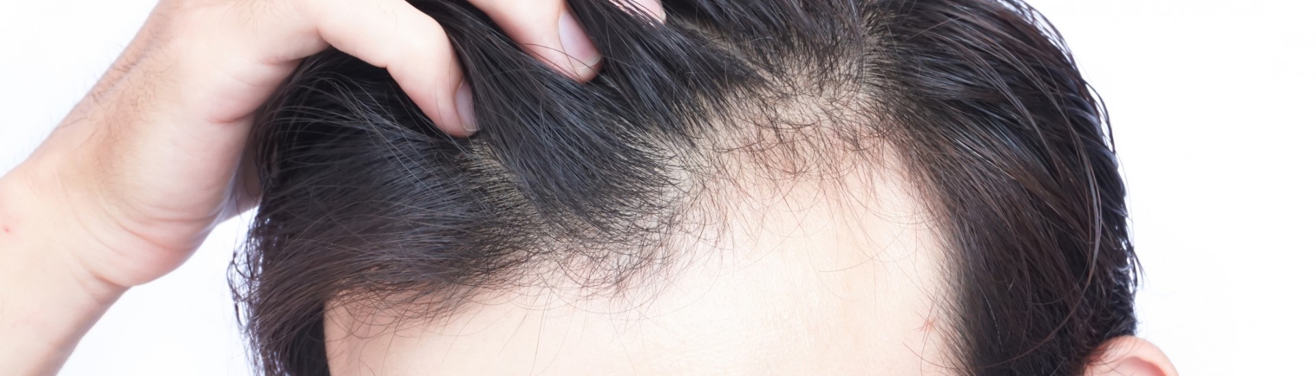 Hair Loss Treatment